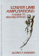 Lower Limb Amputations: A Guide to Rehabilitation