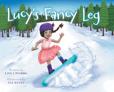 Lucy's Fancy Leg