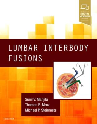 Lumbar Interbody Fusions - Manjila, Sunil V, and Mroz, Thomas, MD, and Steinmetz, Michael P, MD