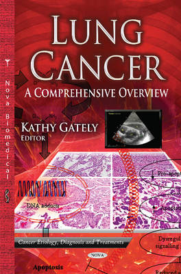 Lung Cancer: A Comprehensive Overview - Gately, Kathy (Editor)