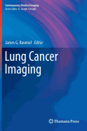 Lung Cancer Imaging