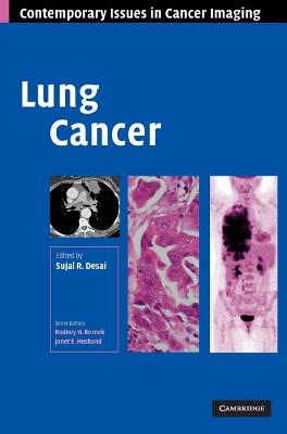 Lung Cancer - Desai, Sujal R. (Editor)