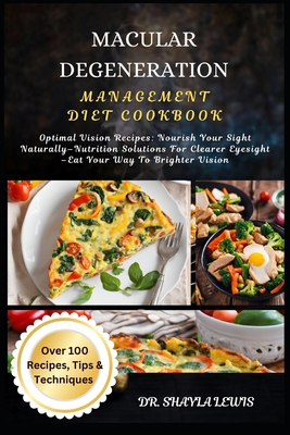 Macular Degeneration Management Diet Cookbook: Optimal Vision Recipes: Nourish Your Sight Naturally-Nutrition Solutions For Clearer Eyesight -Eat Your Way To Brighter Vision - Lewis, Shayla, Dr.