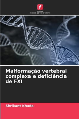 Malforma??o vertebral complexa e defici?ncia de FXI - Khade, Shrikant