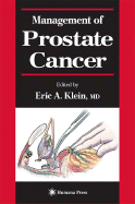 Management of Prostate Cancer - Straffon, Ralph A (Foreword by), and Klein, Eric A (Editor)