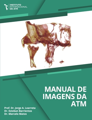 Manual de imagem da articula??o temporomandibular-ATM - Barrientos, Esteban Eduardo, and Matos, Marcelo, and Learreta, Jorge Alfonso, Dds