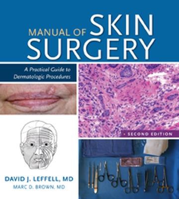 Manual of Skin Surgery: A Practical Guide to Dermatologic Procedures - Leffell, David J