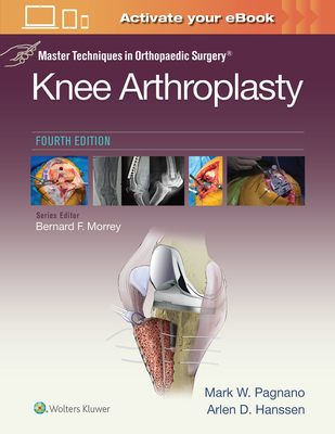 Master Techniques in Orthopedic Surgery: Knee Arthroplasty - Pagnano, Mark W.