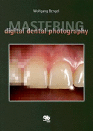 Mastering Digital Dental Photography - Bengel, Wolfgang