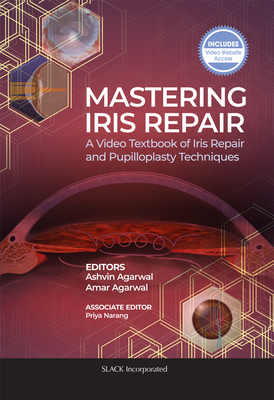 Mastering Iris Repair: A Video Textbook of Iris Repair and Pupilloplasty Techniques - Agarwal, Ashvin, and Agarwal, Amar