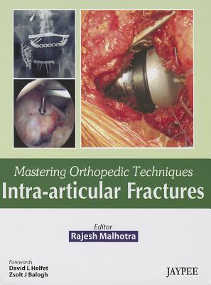 Mastering Orthopedic Techniques: Intra-Articular Fractures - Malhotra, Rajesh