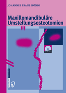 Maxillomandibul?re Umstellungsosteotomien