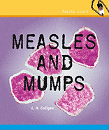 Measles and Mumps