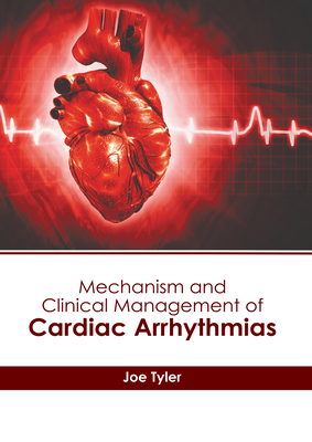 Mechanism and Clinical Management of Cardiac Arrhythmias - Tyler, Joe (Editor)