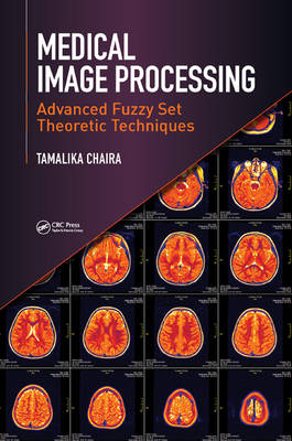 Medical Image Processing: Advanced Fuzzy Set Theoretic Techniques - Chaira, Tamalika