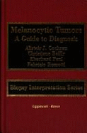 Melanocytic Tumors: A Guide to Diagnosis - Conchran, Alistair J, MD, and Cochran, Alistair, and Remotti, Fabrizio, MD