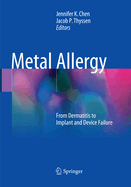 Metal Allergy: From Dermatitis to Implant and Device Failure