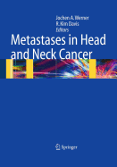 Metastases in Head and Neck Cancer