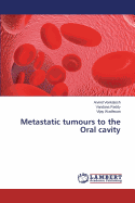 Metastatic Tumours to the Oral Cavity