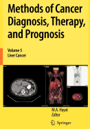 Methods of Cancer Diagnosis, Therapy and Prognosis - Hayat, M a (Editor)