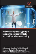 Metoda operacyjnego leczenia olbrzymich wrzod?w dwunastnicy