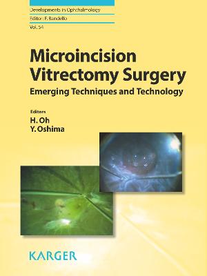 Microincision Vitrectomy Surgery: Emerging Techniques and Technology - Oh, H. (Editor), and Oshima, Y. (Editor), and Bandello, F. (Series edited by)