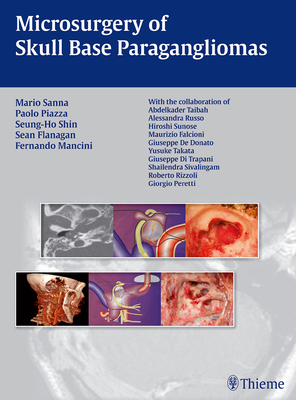 Microsurgery of Skull Base Paragangliomas - Sanna, Mario, and Piazza, Paolo, and Shin, Seung-Ho