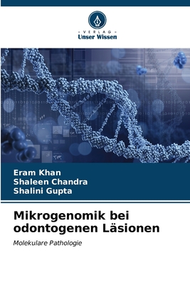 Mikrogenomik bei odontogenen L?sionen - Khan, Eram, and Chandra, Shaleen, and Gupta, Shalini