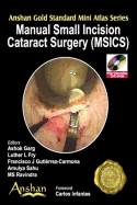 Mini Atlas of Manual Small Incision Cataract Surgery
