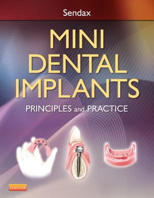 Mini Dental Implants: Principles and Practice - Sendax, Victor Dr