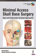 Minimal Access Skull Base Surgery: Open and Endoscopic Assisted Approaches