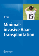 Minimalinvasive Haartransplantation