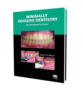 Minimally Invasive Dentistry: The Management of Caries