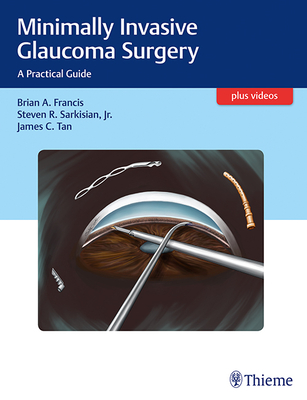 Minimally Invasive Glaucoma Surgery: A Practical Guide - Francis, Brian, and Sarkisian, Steven, and Tan, James C