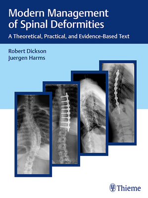 Modern Management of Spinal Deformities: A Theoretical, Practical, and Evidence-Based Text - Dickson, Robert A, and Harms, Jrgen