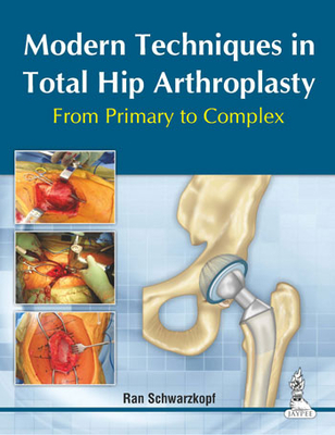 Modern Techniques in Total Hip Arthroplasty: From Primary to Complex - Schwarzkopf, Ran