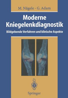 Moderne Kniegelenkdiagnostik: Bildgebende Verfahren Und Klinische Aspekte - Ngele, Matthias, and Gnther, R W (Foreword by), and Adam, Gerhard