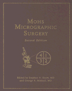 Mohs Micrographic Surgery