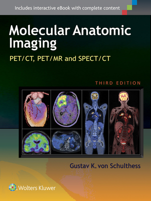 Molecular Anatomic Imaging: PET/CT, PET/MR and SPECT CT - von Schulthess, Gustav K., MD, PhD