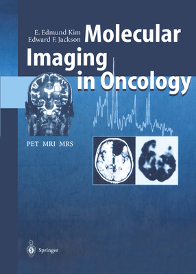 Molecular Imaging in Oncology: Pet, Mri, and Mrs - Kim, E Edmund, and Aoki, J (Contributions by), and Jackson, Edward F