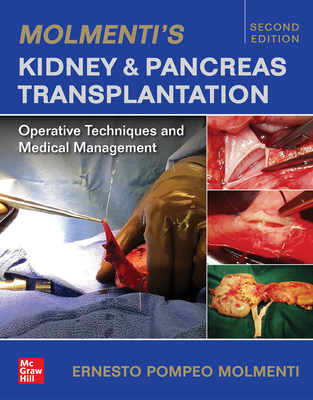 Molmenti's Kidney and Pancreas Transplantation: Operative Techniques and Medical Management - Molmenti, Ernesto P.