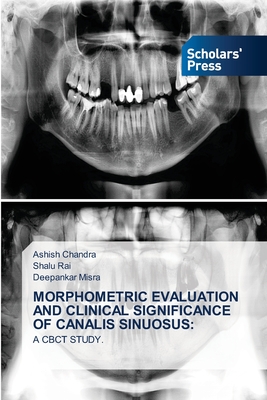 Morphometric Evaluation and Clinical Significance of Canalis Sinuosus - Chandra, Ashish, and Rai, Shalu, and Misra, Deepankar