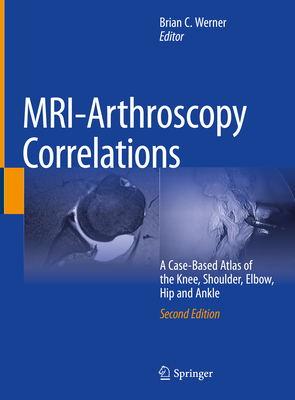 MRI-Arthroscopy Correlations: A Case-Based Atlas of the Knee, Shoulder, Elbow, Hip and Ankle - Werner, Brian C. (Editor)