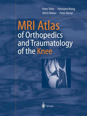 MRI Atlas of Orthopedics and Traumatology of the Knee - Teller, Peter, and Herwig, B (Translated by), and Knig, Hermann