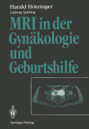 MRI in Der Gyn?kologie Und Geburtshilfe