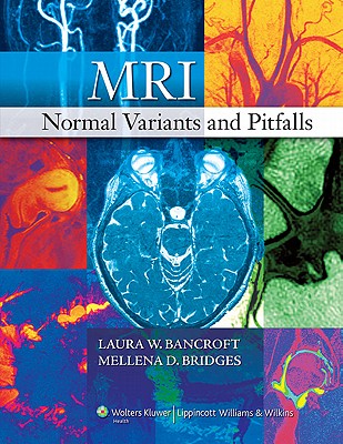 MRI Normal Variants and Pitfalls - Bancroft, Laura W (Editor), and Bridges, Mellena D (Editor)