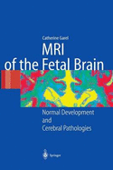 MRI of the Fetal Brain: Normal Development and Cerebral Pathologies