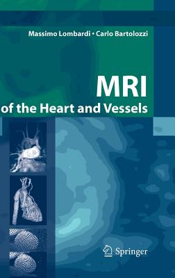 MRI of the Heart and Vessels - Lombardi, Massimo, and Donato, L (Foreword by), and Walker, M (Translated by)