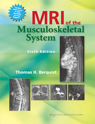 MRI of the Musculoskeletal System with Access Code - Berquist, Thomas H, MD, Facr