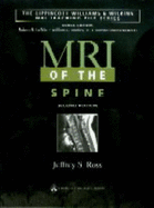 MRI of the Spine - Ross, Jeffrey S, MD